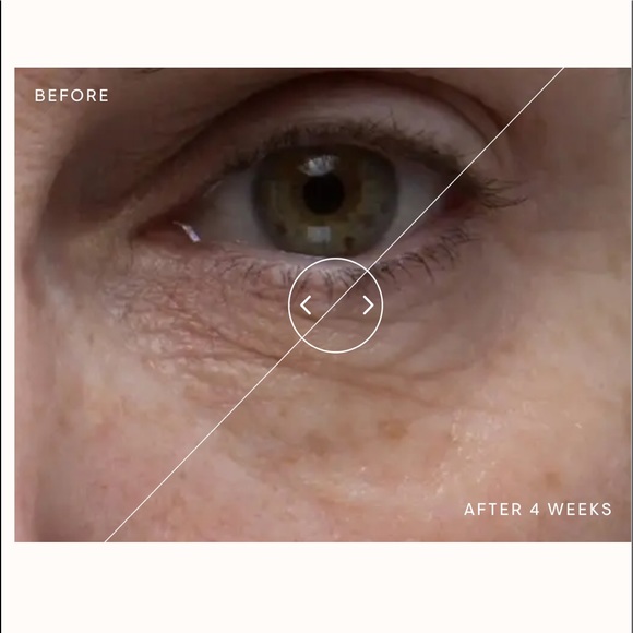 💙🆕💙 ELEMIS Peptide4 Eye Recovery Cream - Picture 3 of 6